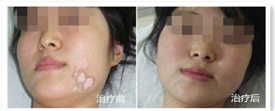 20161104_1478243770_798723.jpg 1-160G509444UU.jpg