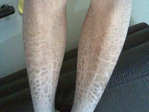 �������۲�Ӧ����ô����