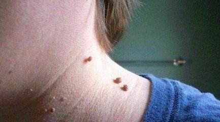 Ԥ����ƽ������Щ����