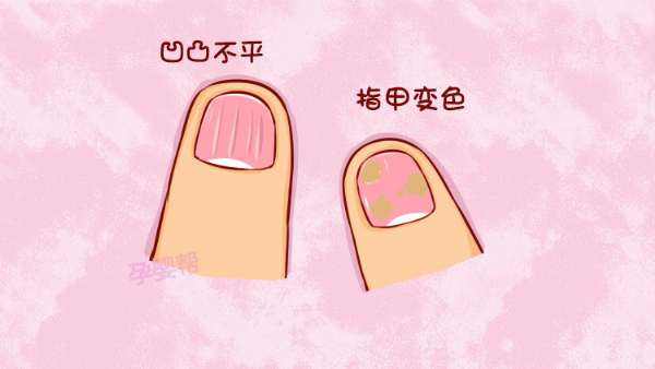 ��ָ�׻�����η�ֹ��Ⱦ